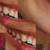 thumb-4
